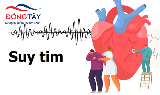 Suy tim là biến chứng nguy hiểm thường thấy ở người bệnh thiếu máu cơ tim